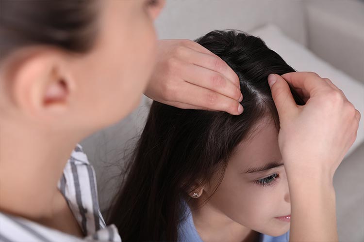 Обнаружили вши у девочки на длинных волосах